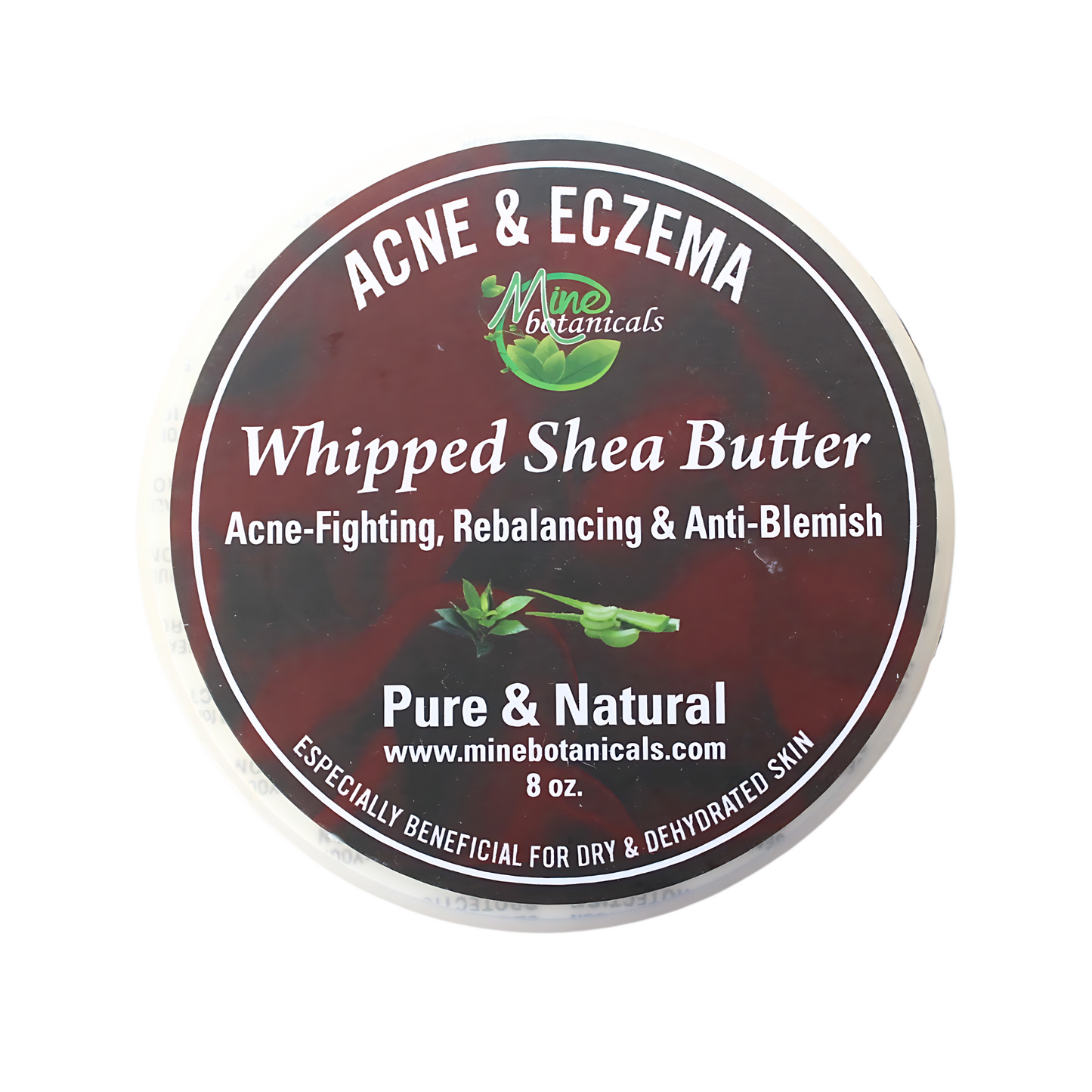 ACNE & ECZEMA Whipped Shea Butter