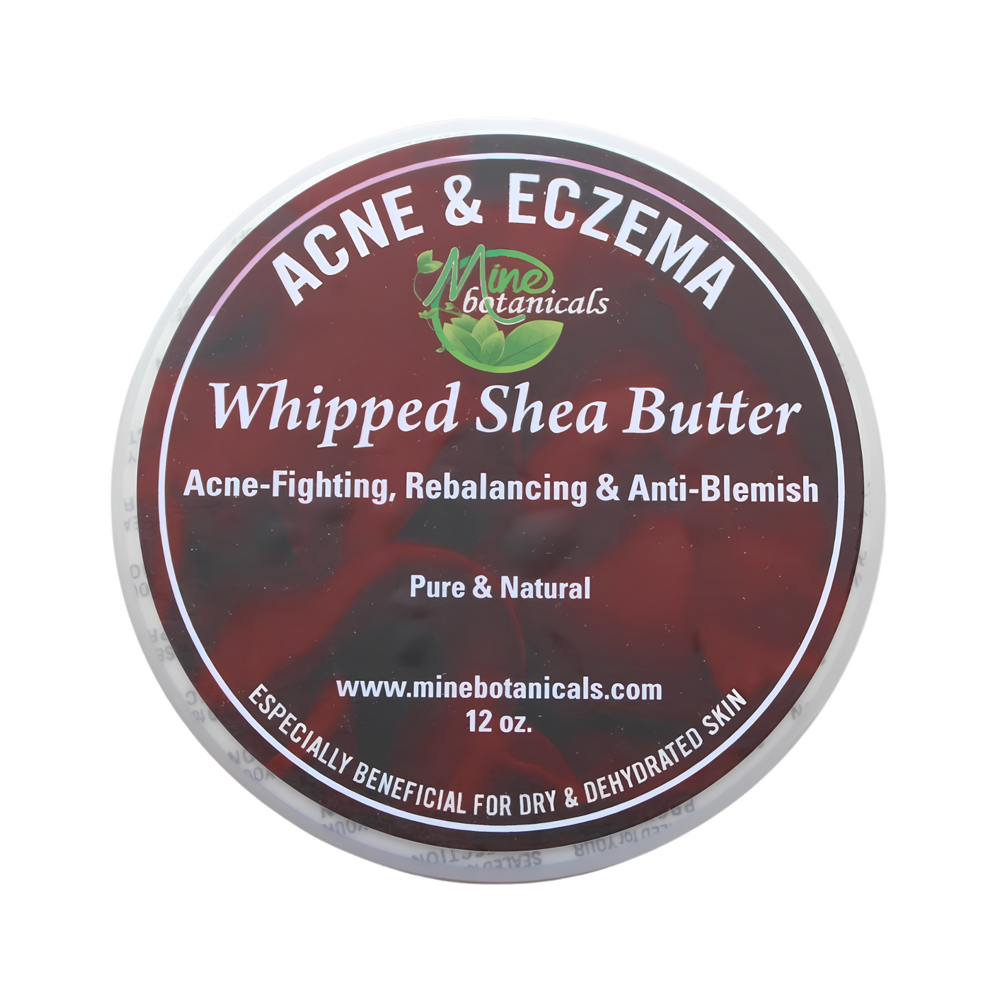 ACNE & ECZEMA Whipped Shea Butter